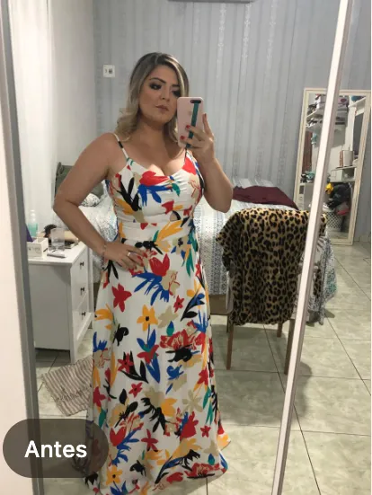 Fabiola antes do tratamento