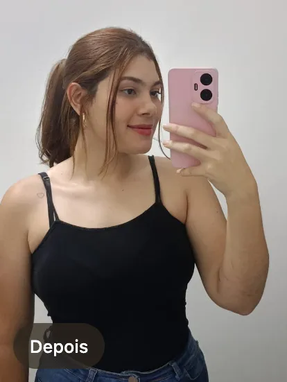 Giullia depois do tratamento